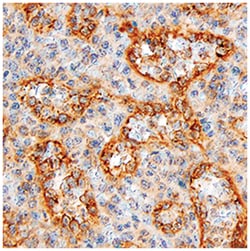 Human HVEM/TNFRSF14 Antibody, R D Systems 100 &mu;g | Buy Online | R&D Systems | Fisher Scientific