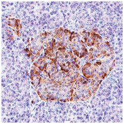 Human IGFBP-rp1/IGFBP-7 Antibody, R D Systems:Antibodies:Primary Antibodies