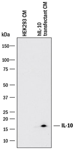 Human IL-10 Antibody, R D Systems 100&mu;g; Unlabeled:Antibodies, Monoclonal