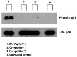 R D Systems Recombinant Human/Mouse/Rat Irisin Protein 25 &mu;g | Buy Online | R&amp;D Systems&trade; | Fisher Scientific