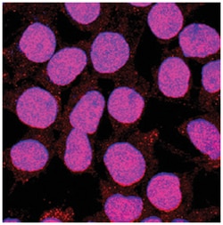 Human KLF12 Antibody, R D Systems 25&mu;g; Unlabeled:Antibodies, Monoclonal