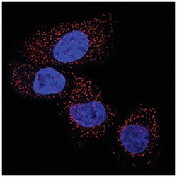 Human/Rat Lactate Dehydrogenase A/LDHA Antibody, R D Systems 100 &mu;g | Buy Online | R&D Systems | Fisher Scientific