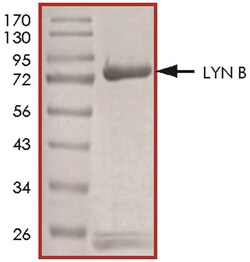 R D Systems Recombinant Human Active Lyn B Protein, CF 10 &mu;g | Buy Online | R&amp;D Systems&trade; | Fisher Scientific