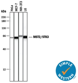 Human/Mouse/Rat MST2/STK3 Antibody, R D Systems:Antibodies:Primary Antibodies