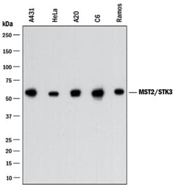 Human/Mouse/Rat MST2/STK3 Antibody, R D Systems:Antibodies:Primary Antibodies