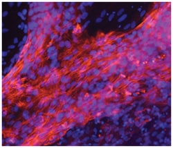 Human MYH7 Antibody, R D Systems 25&mu;g; Unlabeled:Antibodies, Monoclonal