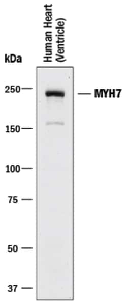 Human MYH7 Antibody, R D Systems 25&mu;g; Unlabeled:Antibodies, Monoclonal