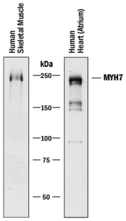 Human MYH7 Antibody, R D Systems:Antibodies:Primary Antibodies