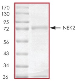 R D Systems Recombinant Human Active NEK2 Protein 10 &mu;g | Buy Online | R&amp;D Systems&trade; | Fisher Scientific