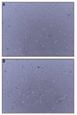 R D Systems Recombinant Human Neuroligin 4Y/NLGN4Y Protein 50 &mu;g | Buy Online | R&amp;D Systems&trade; | Fisher Scientific