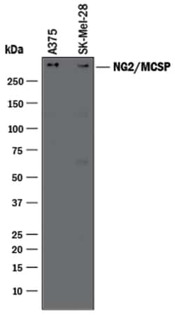 Human NG2/MCSP Antibody, R D Systems 100μg; Unlabeled:Antibodies, Polyclonal