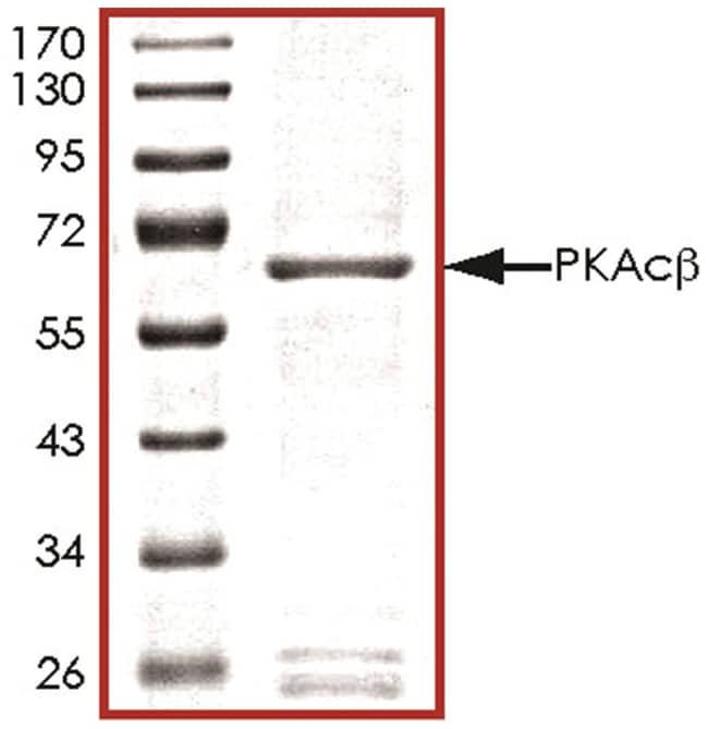 R&D Systems™ Human Active PKA C beta Protein 10ug, Carrier