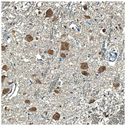 Human Presenilin-1 N-Terminal Fragment Antibody, R D Systems 500ug; Unlabeled:Antibodies,