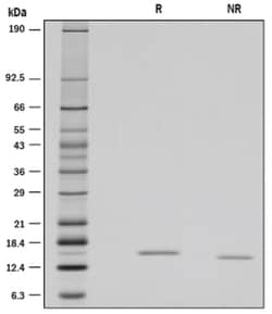 R&D Systems&trade;&nbsp;Recombinant Rat Reg3B Protein