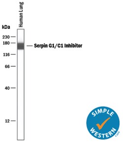 Human Serpin G1/C1 Inhibitor Antibody, R D Systems 25&mu;g; Unlabeled:Antibodies,