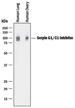 Human Serpin G1/C1 Inhibitor Antibody, R D Systems 25&mu;g; Unlabeled:Antibodies,