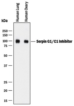 Human Serpin G1/C1 Inhibitor Antibody, R D Systems 25&mu;g; Unlabeled:Antibodies,