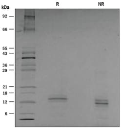 R D Systems Recombinant Human Sonic Hedgehog Protein, High Activity 5&mu;g | Buy Online | R&amp;D Systems&trade; | Fisher Scientific