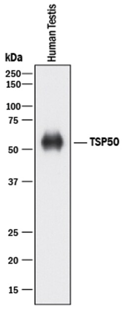 Human TSP50 Antibody, R D Systems 100&mu;g; Unlabeled:Antibodies, Polyclonal