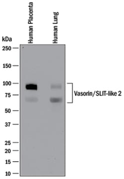 Human Vasorin/SLIT-like 2 Antibody, R D Systems 25 &mu;g | Buy Online | R&D Systems | Fisher Scientific