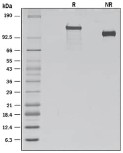 R D Systems Recombinant Human VLDLR Protein 25ug; Carrier Free | Buy Online | R&amp;D Systems&trade; | Fisher Scientific