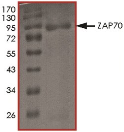 R D Systems Recombinant Human Active ZAP70 Protein 10ug, Carrier Free | Buy Online | R&amp;D Systems&trade; | Fisher Scientific
