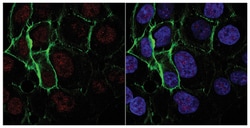 MilliporeSigma anti-Nibrin/Nbs1 Clone: EE15, 200&mu;g, Unlabeled:Antibodies,