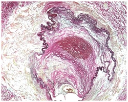 MilliporeSigma&trade;&nbsp;EMD Milllipore&trade; Elastica van Gieson Staining Kit