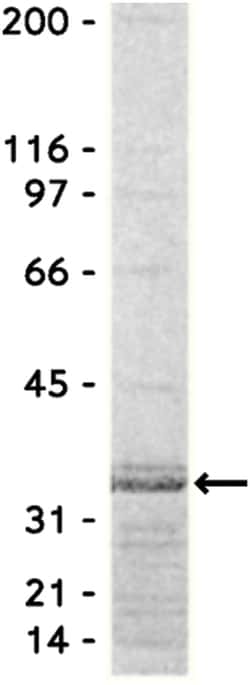 MilliporeSigma™ Upstate™ Rho Assay Reagent (Rhotekin RBD, Agarose)