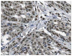 MilliporeSigma Rabbit anti-FOXL1, Polyclonal, 100 &mu;g | Buy Online | MilliporeSigma&trade; | Fisher Scientific