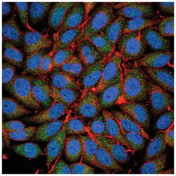 MilliporeSigma Rabbit anti-ICAT, Polyclonal, 100&mu;g:Antibodies, Polyclonal
