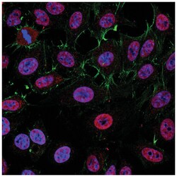 MilliporeSigma KAT7 (HBO1 / MYST2), Rabbit, Unlabeled, Polyclonal, 100 &mu;g | Buy Online | MilliporeSigma&trade; | Fisher Scientific