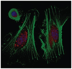 MilliporeSigma Rabbit anti-TERT, Polyclonal, 100&mu;g:Antibodies, Polyclonal