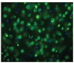 MilliporeSigma MeCP2, Rabbit, Unlabeled, Polyclonal, 100&mu;g; Unlabeled:Antibodies,