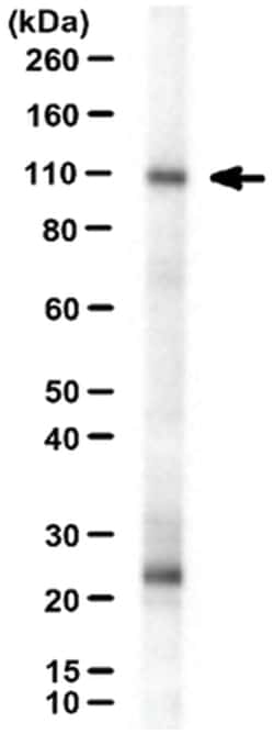 MilliporeSigma Rabbit anti-Neph1, Polyclonal, 100&mu;L:Antibodies, Polyclonal