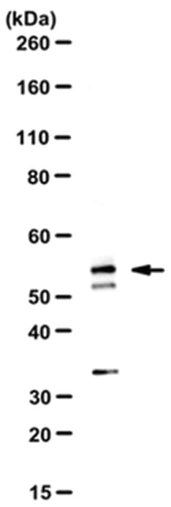 MilliporeSigma PP2A B subunit isoform B56-gamma, Rabbit, Unlabeled, Polyclonal,