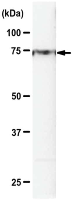 MilliporeSigma HRD1, Rabbit, Unlabeled, Polyclonal, 100&mu;L; Unlabeled:Antibodies,