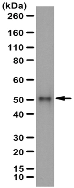 MilliporeSigma Rabbit anti-SPTLC1, Polyclonal, 100&mu;L:Antibodies, Polyclonal
