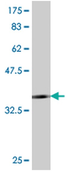 MilliporeSigma anti-TLR4 Clone: 1H7, 100&mu;g, Unlabeled:Antibodies, Monoclonal