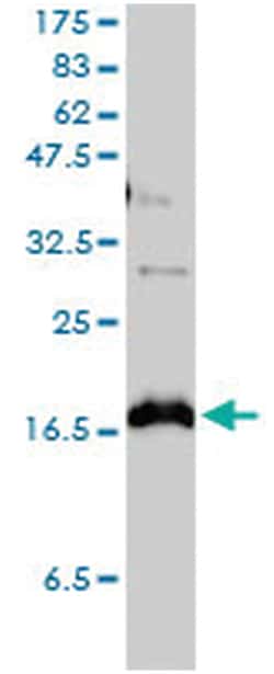 MilliporeSigma anti-CLDN1 Clone: 1C5-D9, 100&mu;g, Unlabeled:Antibodies,