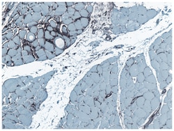 Fibroblasts Mouse anti-Human, Clone: TE-7, MilliporeSigma 100&mu;g; Unlabeled:Antibodies,