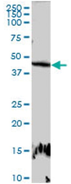 MilliporeSigma anti-E2F2, Polyclonal 100&mu;g, Unlabeled:Antibodies, Polyclonal