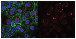 MilliporeSigma Mouse anti-Cytokeratin 5,6, Clone: D5/16B4, Alexa Fluor