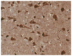 MilliporeSigma anti-Tau Clone: Tau-2, 100&mu;g, Unlabeled:Antibodies, Monoclonal