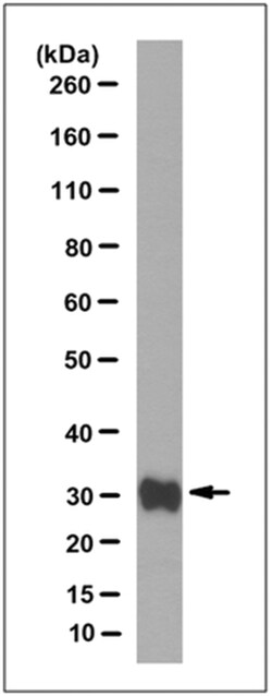 MilliporeSigma Mouse anti-Kallikrein-1/KLK1, Clone: 11C7.1, 100&mu;g:Antibodies,