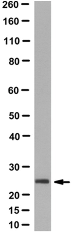 MilliporeSigma Mouse anti-Thymidylate Kinase/TMPK, Clone: 1A5.1, 100&mu;g:Antibodies,
