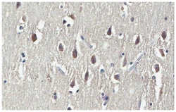 MilliporeSigma Mouse anti-PD-L1, Clone: 29E.2A3.C6, 100&mu;g:Antibodies,