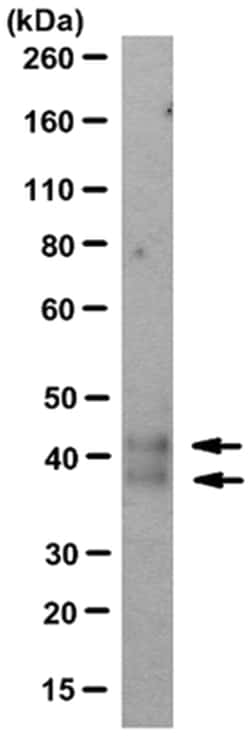 MilliporeSigma Mouse anti-CD1d, Clone: D5, 200&mu;g:Antibodies, Monoclonal
