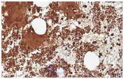 MilliporeSigma Mouse anti-FCGR2A/C, Clone: 11B6, 100&mu;g:Antibodies, Monoclonal