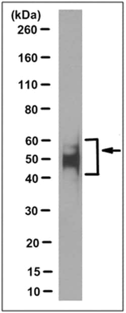MilliporeSigma Tau (4-repeat isoform RD4), Mouse, Unlabeled, Clone: 7D12.1, 100 &mu;g | Buy Online | MilliporeSigma&trade; | Fisher Scientific